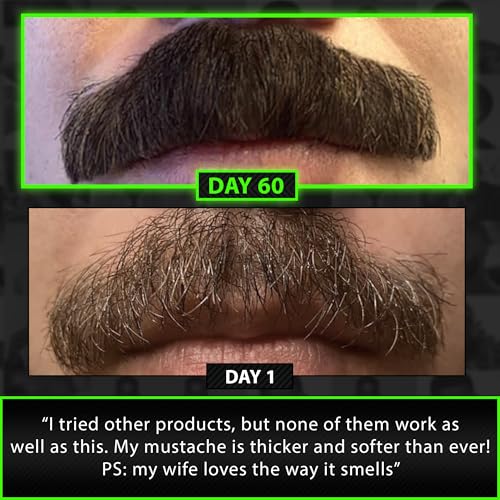 GROW Beard Growth Serum + 2X Biotin Beard Balm ? Thickening Conditioner with Castor Oil & Meadowfoam ? Fills Patches, Boosts Growth, Softens & Styles ? For Thicker, Fuller Men's Facial Hair
