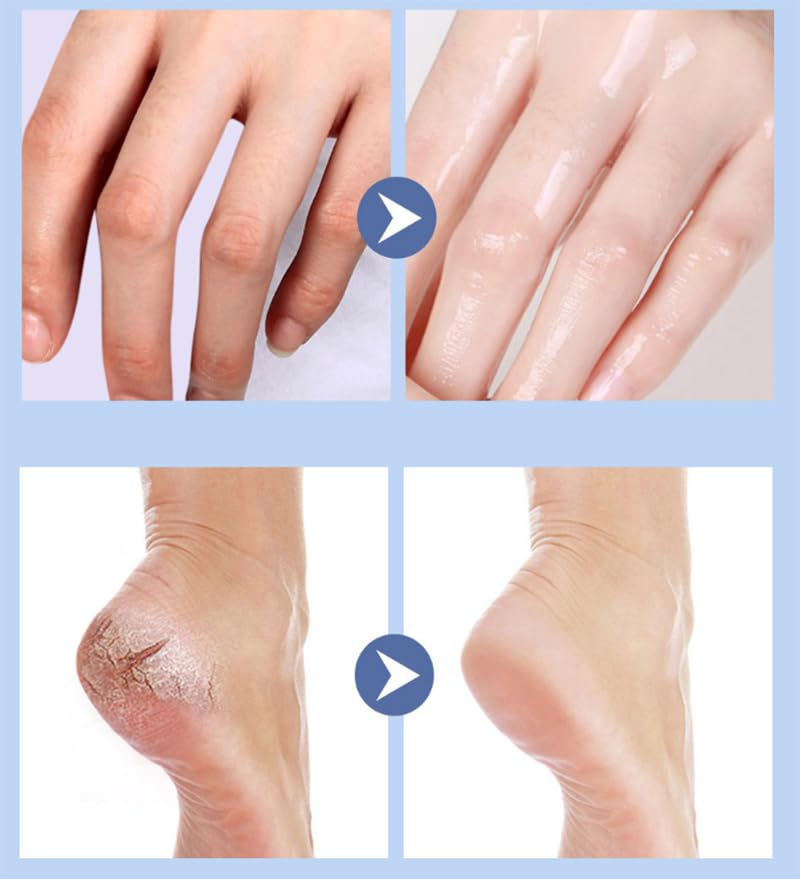 Anti Crack Foot Cream Stick, Crack Feet Prevention Stick, Foot Care Cream Roll On, Dead Skin Removal Moisturizer, Callus Remover For Dry Feet (Blue*2)