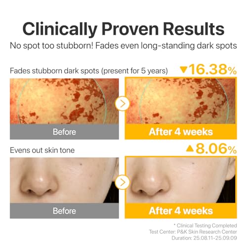 Numbuzin No.5 Glutathione TXA Dark Spot Ampoule 0.35 Fl Oz - Brightening Serum for Uneven Skin