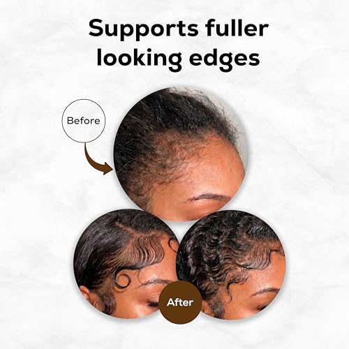 Black Seed Oil for Hair Growth & Nourishment - 8 oz Hair Treatment