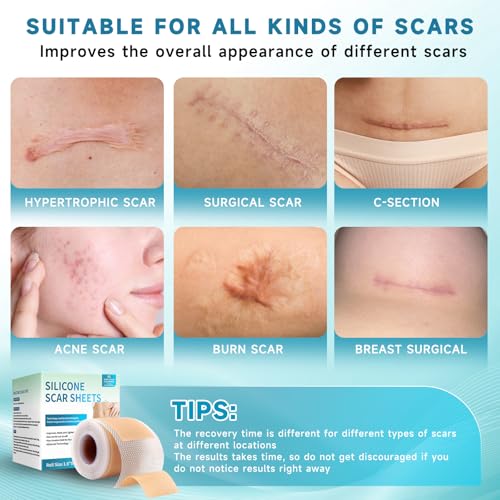 Rvlaim Medical-Grade Silicone Scar Sheets 4M Roll for Keloid & Surgical Scars