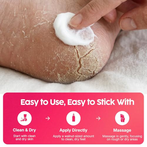 Footlogix Rough Skin Foot Mousse with Urea & Tea Tree Oil - Lightweight Moisturizer for Dry Feet - 4.23 oz