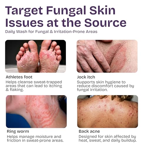 Shailee Antifungal Body Wash with Tea Tree Oil for Eczema, Jock Itch & Ringworm - 1% Tolnaftate, Deep Cleansing for Acne & Fungal Skin
