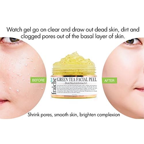 Live Fraiche 24k Gold Brightening Facial Peeling Gel Green Tea - 4.23oz -Secret Cure to Clogged Pores -Gentle Deep Exfoliator Key to Remove Dead Skin & Dirt for forever flawless clearer younger skin