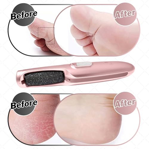 Powerful Electric Callus Remover Wand ? Rechargeable Foot File, Grinder & Scrubber - Removes Dead, Hard Skin & Calluses ? Best Pedicure Tool for Soft, Smooth Feet for Men & Women (Rose Gold)