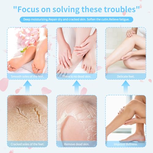 Electric Foot Callus Remover, Rechargeable Foot File with Patented 3D Roller & LED Light, 2-Speed Foot Exfoliator for Dead Skin