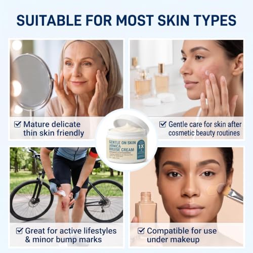 Arnica Bruise Cream with Vitamins K, C & E - Supports Skin Healing, 4.23 oz