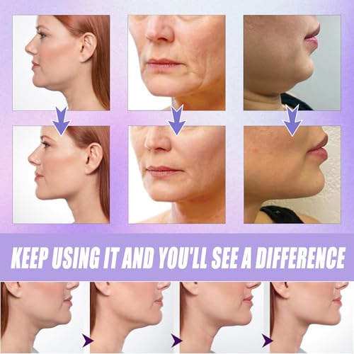 160PCS Face Lift Tape for Wrinkles & Sagging Skin ? Invisible Facelift Strips for Women, Waterproof & Comfortable, Natural V-Shape Lifting Support Aloe Vera