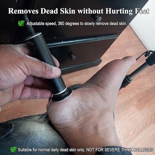 I·B·N G 1st Gen Black Electric Callus Remover Foot Sander with 60 Discs