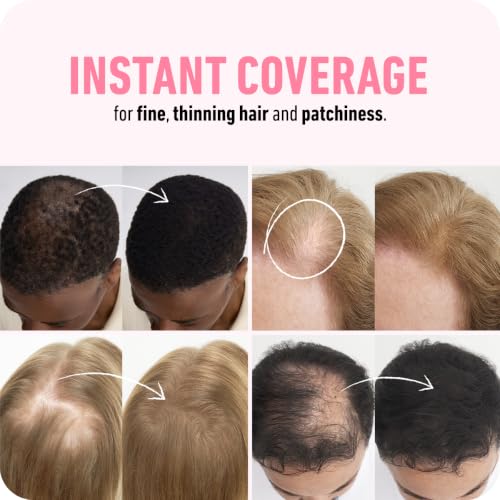 Boldify Hair Fibers for Thinning Hair - Dark Brown, 28g - Instant Volume & Concealer
