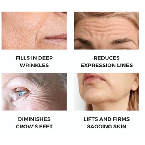 Noviqo Freeze Dried Collagen for Face,Anti-Wrinkle Nano-Silk Collagen System,Serum Skin Care for Face & Eye,At-Home-Hydrating