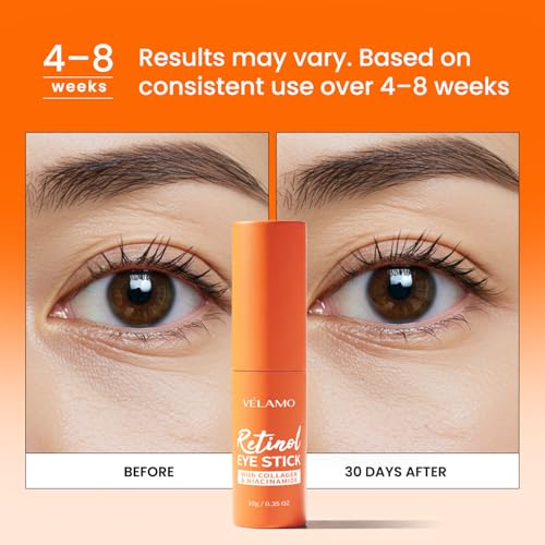 Korean Retinol Eye Balm Set - 10g 2-Pack, Upgraded Formula for Dark Circles Puffiness & Wrinkles - Hypoallergenic & Brightening