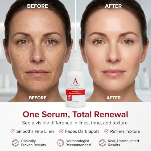 Alpha Skin Care Renewal Serum with 14% Glycolic AHA - 2 Oz - Anti-Aging Facial Treatment