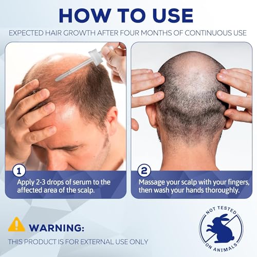Minoxidil 5% Hair Growth Serum for Men and Women - 2 Bottles - Thicker, Fuller Hair Regrowth Treatment