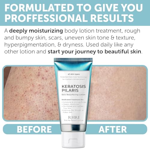 KP Bump Eraser Body Scrub with 10% AHA | Keratosis Pilaris Treatment | Bump Eraser Body Scrub | Ingrown Hair Treatment | Clears Strawberry Legs | Soothes Redness, Dryness & Flaky Skin