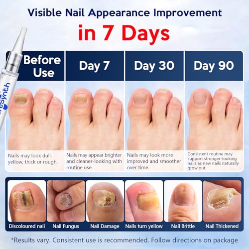 White Extra Strength Nail Repair Pen - 25% Undecylenic Acid, Aloe & Vitamin E, 8-Pack