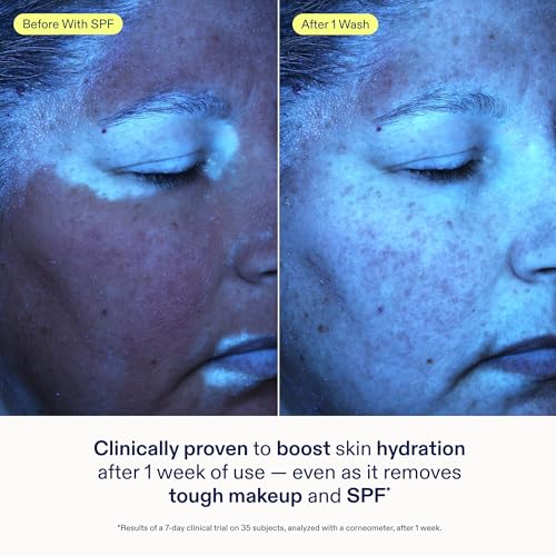 Skinfix Ceramide + Ectoin Gentle Gel Cleanser - 5 oz - SPF + Makeup Remover - Hydrates Skin - Vegan, Cruelty Free
