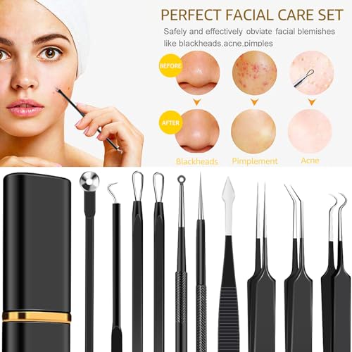 Black 40pcs Professional Pimple Popper Tool Kit for Salons & Estheticians