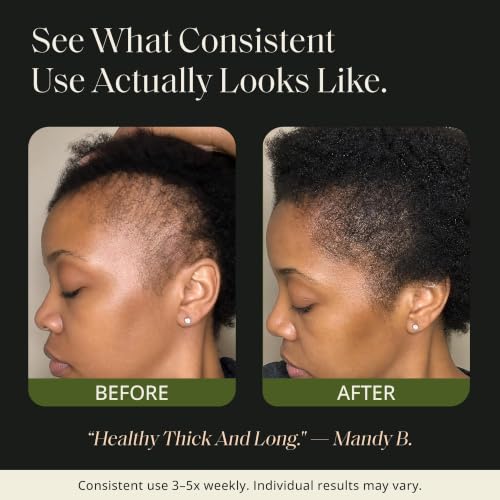 Glossed By Nae Voodoo Hair Growth Oil - Rosemary, Lemongrass & Castor Oil - All Hair Types - 4 Fl Oz - Variation 1