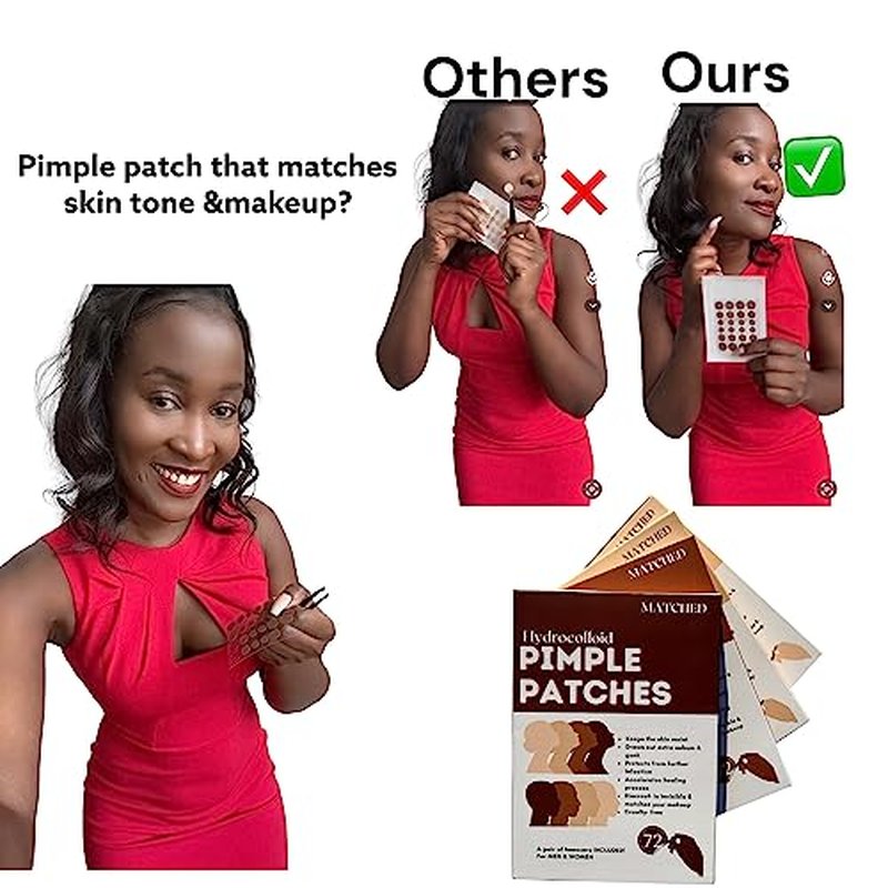MATCHED Hydrocolloid Pimple Patches-Invisible Acne Patches for Face, 3 Sizes, 72-Count (1 Pack),Zit patches that match Skin tone for Daytime Use, for proactive acne treatment (NRB)