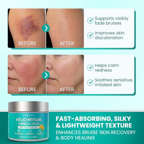 Extra Strength Arnica Bruise Cream for Sensitive Skin - 3.4oz