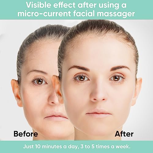 Microcurrent Facial Device, 5 Intensity Levels Face Massager with Red Light Therapy, Portable Microcurrent Facial Roller for Wrinkles, Toning & Skin Tightening