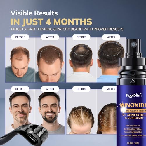 Minoxidil Hair & Beard Growth Kit 2.01 Fl Oz - Extra Strength with Rosemary for Faster Thicker Results