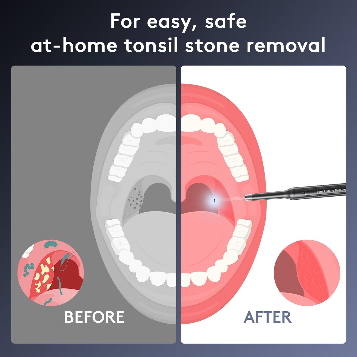 Tonsil Stone Removal Kit with Camera- 2025 Upgraded Tonsil Stone Remover Tool Connect with WIFI - Visual Led Light Tonsillolith Removal Tool with 4 Head Attachments (Black)