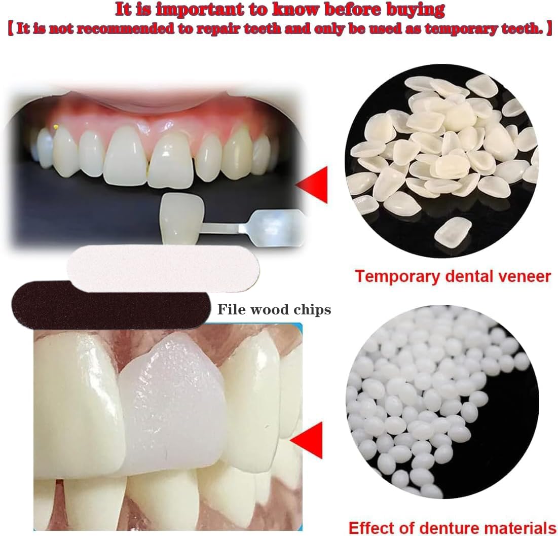 VEZE Tooth Repair Kit-Thermal Fitting Beads Granules and Fake Teeth for Temporary Fixing Missing and Broken Tooth, Moldable Fake Teeth and Thermal Beads Replacement Kit.【Teeth - Piece Yellow】