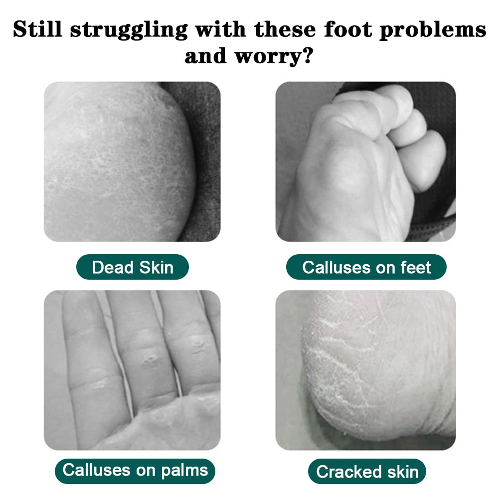 10 in 1 Pedicure Set for Feet, Professional Pedicure Foot Spa Set, Stainless Steel Foot Care Kit, File Callus Remover, Rasp Dead Skin Remover