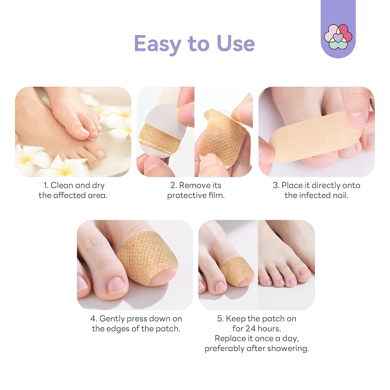 Overnight 1% Tolnaftate Fungal Nail Patches for Toenails - 96 Patches (Variation: 96 Patch)