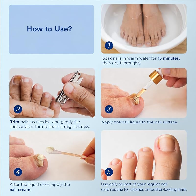 Toenail Fungus Treatment Kit - 32 Fungal Nail Patches + 15mL Liquid + 20g Cream (Red Patches)