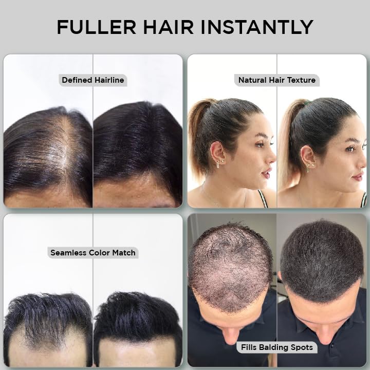 THICK FIBER Hair Fibers for Thinning Hair & Bald spots (BLACK) - 25g Bottle - Conceals Hair Loss in Seconds - Hair Powder for Women & Men