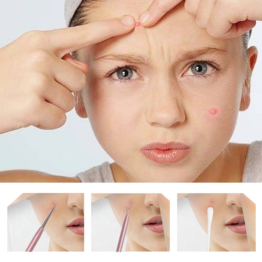 GIHWRRIProfessional Blackhead Removal Tool Set, 5 Piece Stainless Steel Comedone Extractors, Pink