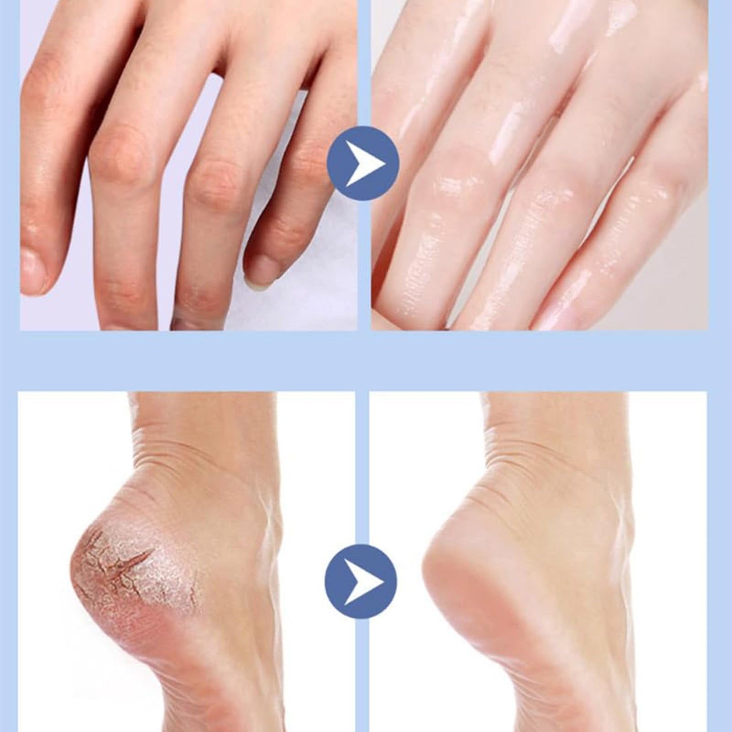 LONDRAF Eourhsa Crack Feet Prevention Stick, Hydrating Foot Balm Stick, Refreshingly Smooth Non-greasy Texture for Dry Cracked Feet, Refreshing, Hydrating (C, 1)