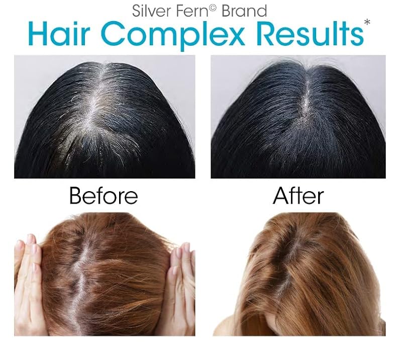 2 Ounce Silver Fern Hair Complex Hair Supplement for Healthy Hair - 30 Capsules