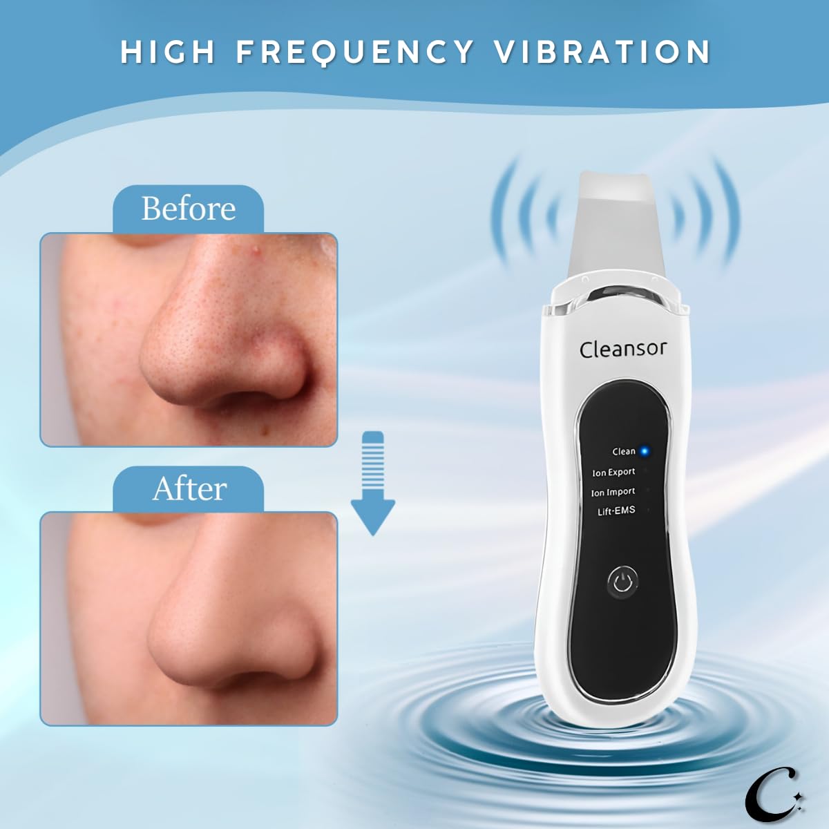 Skin Scrubber Pore Cleaner Blackhead Remover Facial Spatula with Clean, Ion and Lift Modes