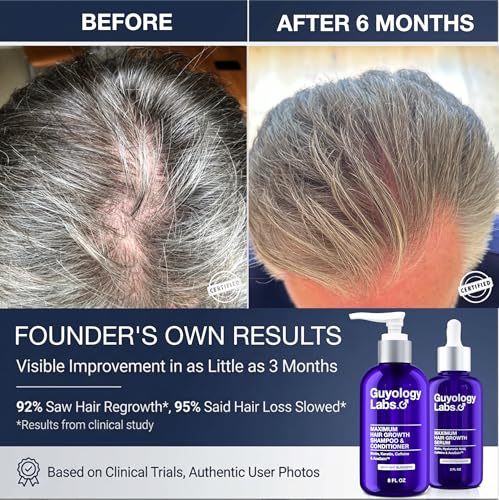 Hair Growth Serum for Men & Women - DHT Blocker & Regrowth Treatment with Biotin & Caffeine