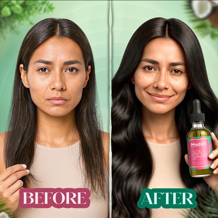 Hair Growth Oil for Thinning Hair & Scalp Stimulator - All Hair Types, 2 oz