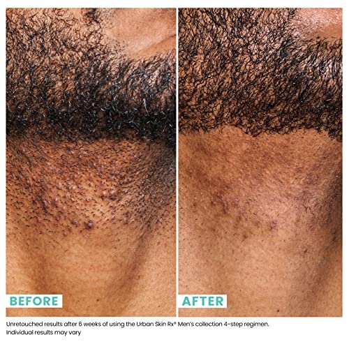 Urban Skin Rx¢ç Men's Clear & Smooth Daily 2-In-1 Cleansing Face Wash + Exfoliating Scrub, Improves the Look of Ingrown Hairs & Clogged Pores, Brightens Dull Complexions, Smooths Rough Texture, 5.1 Oz