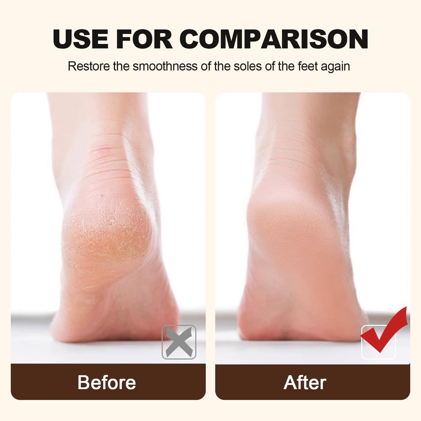 Foot Rasp Foot File and Callus Remover, Professional Foot Care Pedicure Stainless Steel File，Effective Dead Skin and Callus Remover for Smooth（Pink）