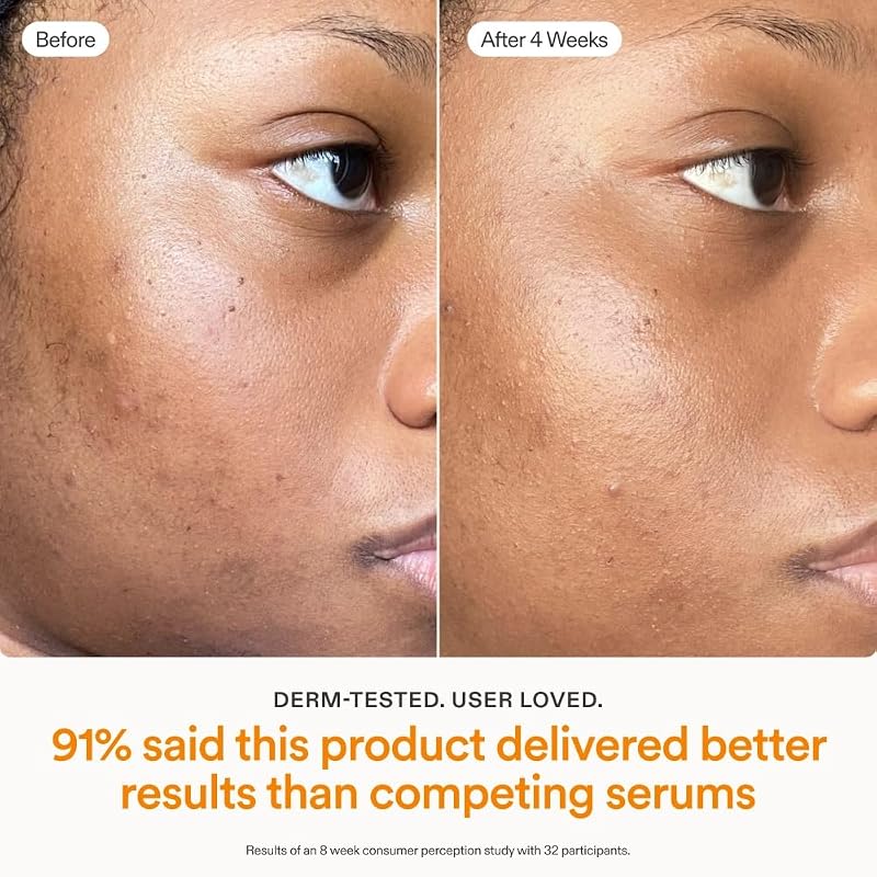 Vitamin C Serum for Face 15% THD Ascorbate | Brightens & Firms Skin