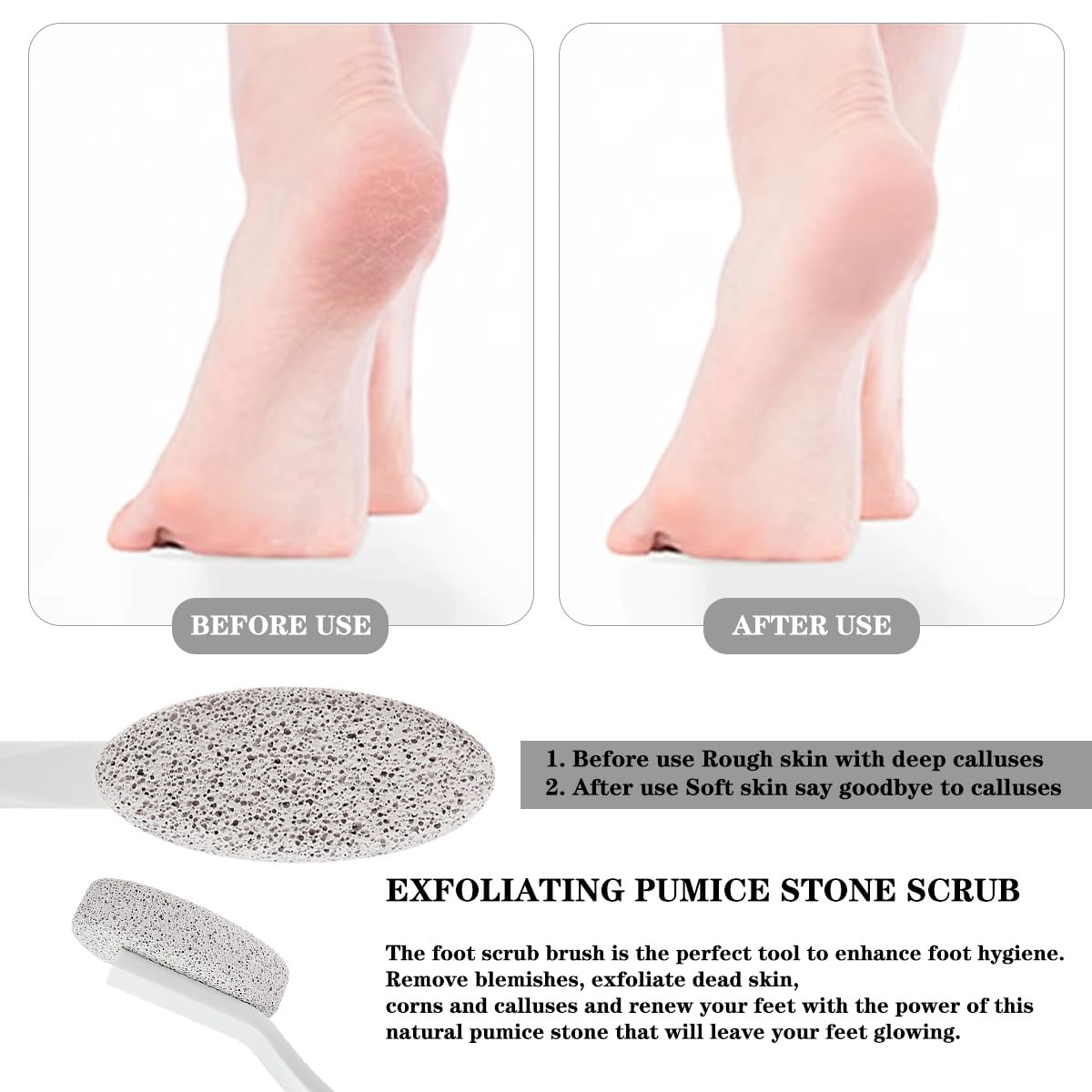 Long Handle Pumice Stone, Exfoliating Dead Skin Remover with 35cm Handle for Easy Foot Care - Suitable for Pedicure, Massage and Scrubbing