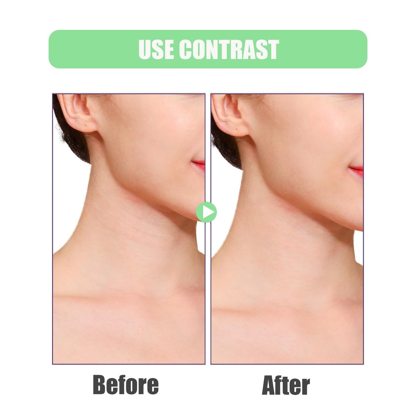 Edskyscraper Neck Tape, 40/120 PCS Neck Tape Lift Turkey Neck, Face Lifting Tape Invisible, For Lifting Loose Sagging Skin, Eye, Cheek, Double Chin, For Women Behind Neck (A(80Patches))