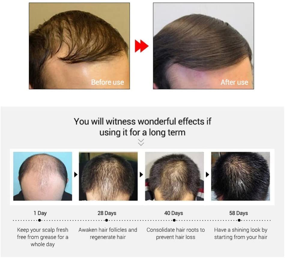 Magic Hair Growth Tonic with Ginseng – 60ML Hair Loss Treatment for Men & Women, Fast Hair Regrowth Serum for Thicker, Fuller Hair