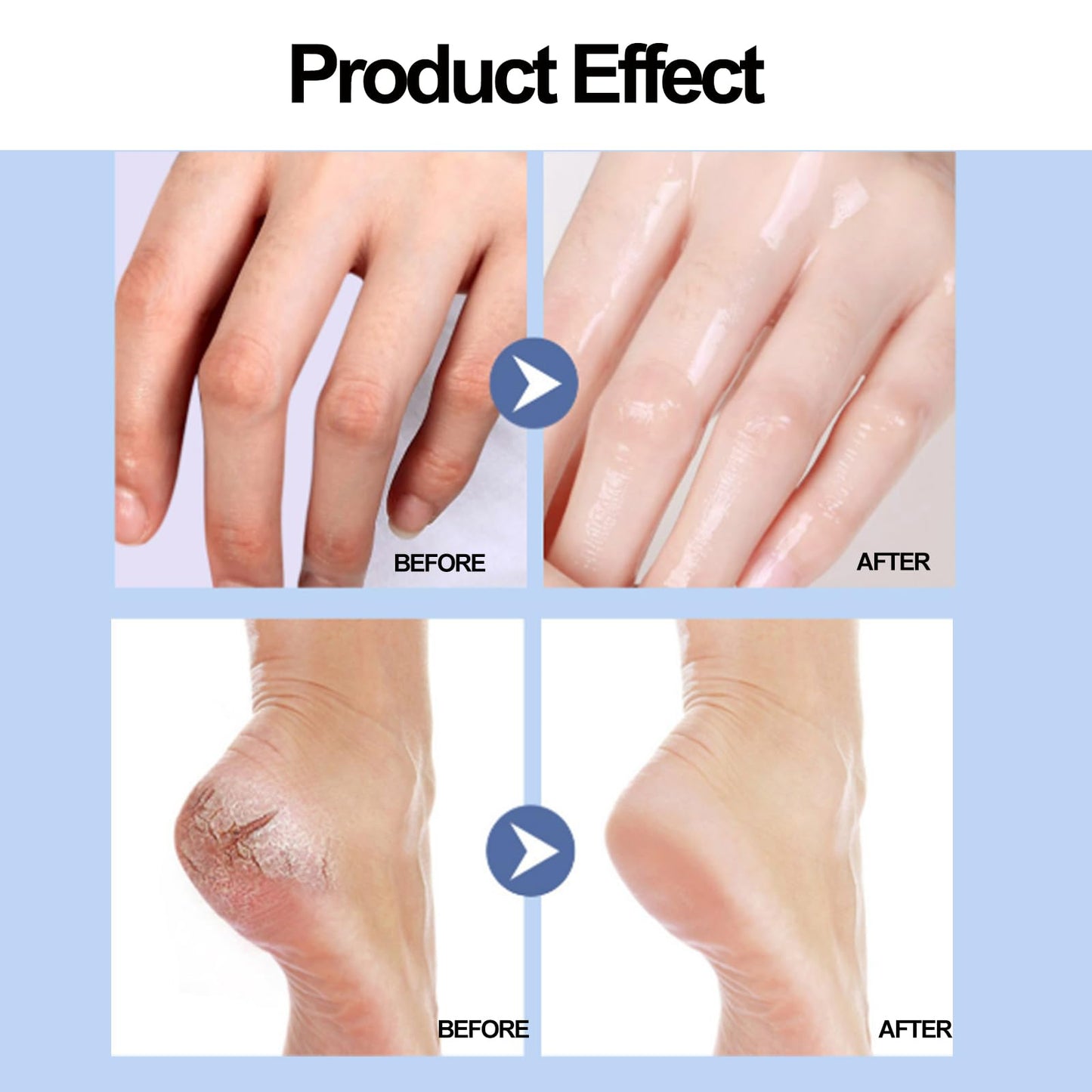 Equrhsa Foot Care Cream Cracked Feet, Eourhsa Crack Feet Prevention Stick, Equersha Foot Balm, cracked Heel Stick Balm, Anti Cracked foot Cream for Dry Heels, Hydrating and Smoothing (Pink, 1)