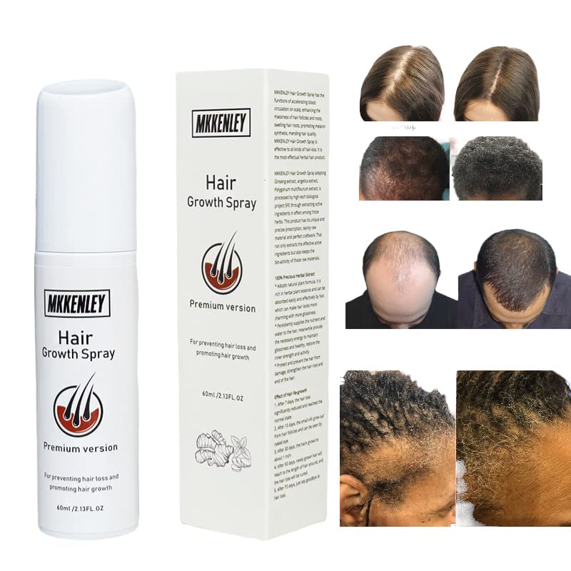 Magic Hair Growth Tonic with Ginseng – 60ML Hair Loss Treatment for Men & Women, Fast Hair Regrowth Serum for Thicker, Fuller Hair