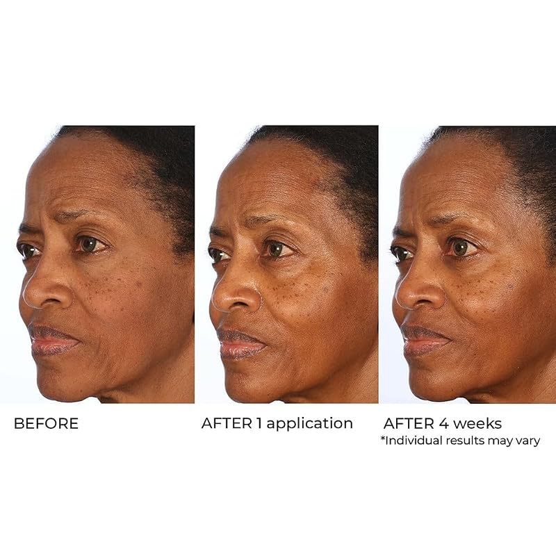 Vitamin C Serum with Omega-3 & Squalane for Brightening & Hydration