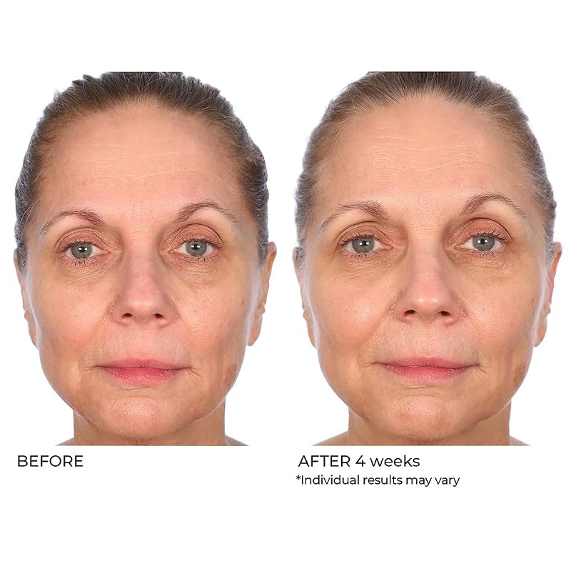 Vitamin C Serum with Omega-3 & Squalane for Brightening & Hydration