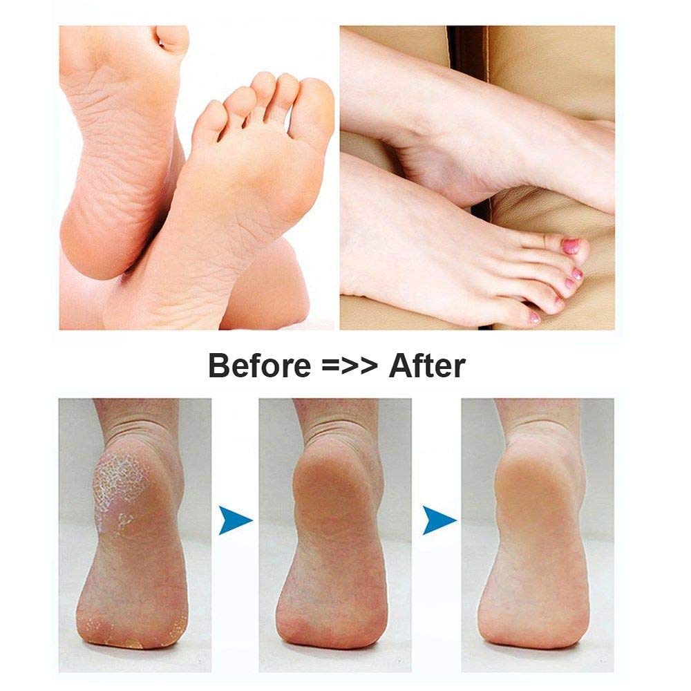 BOMPOW Electric Foot File Hard Skin Remover Pedicure Tools Electronic Callus kit for Cracked Heels and Dead Skin with 2 Roller Heads, Black